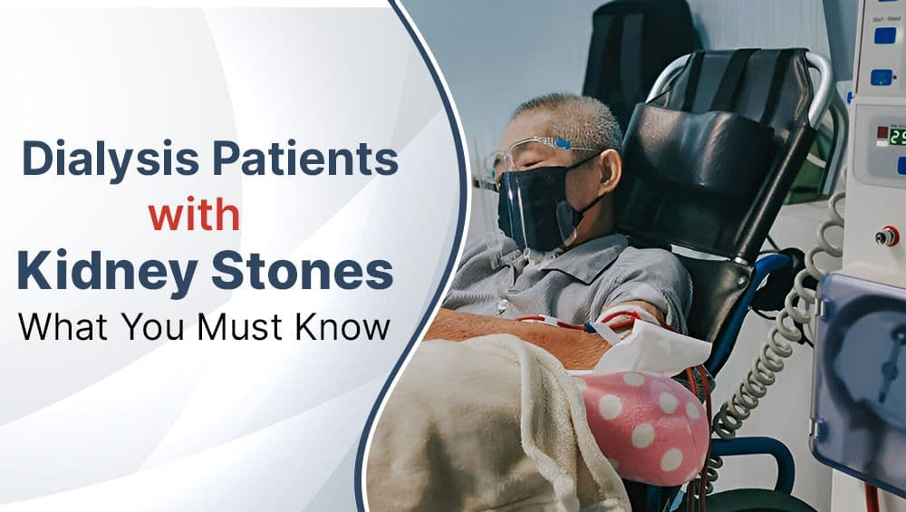 Dialysis Patients with Kidney Stones: What You Must Know