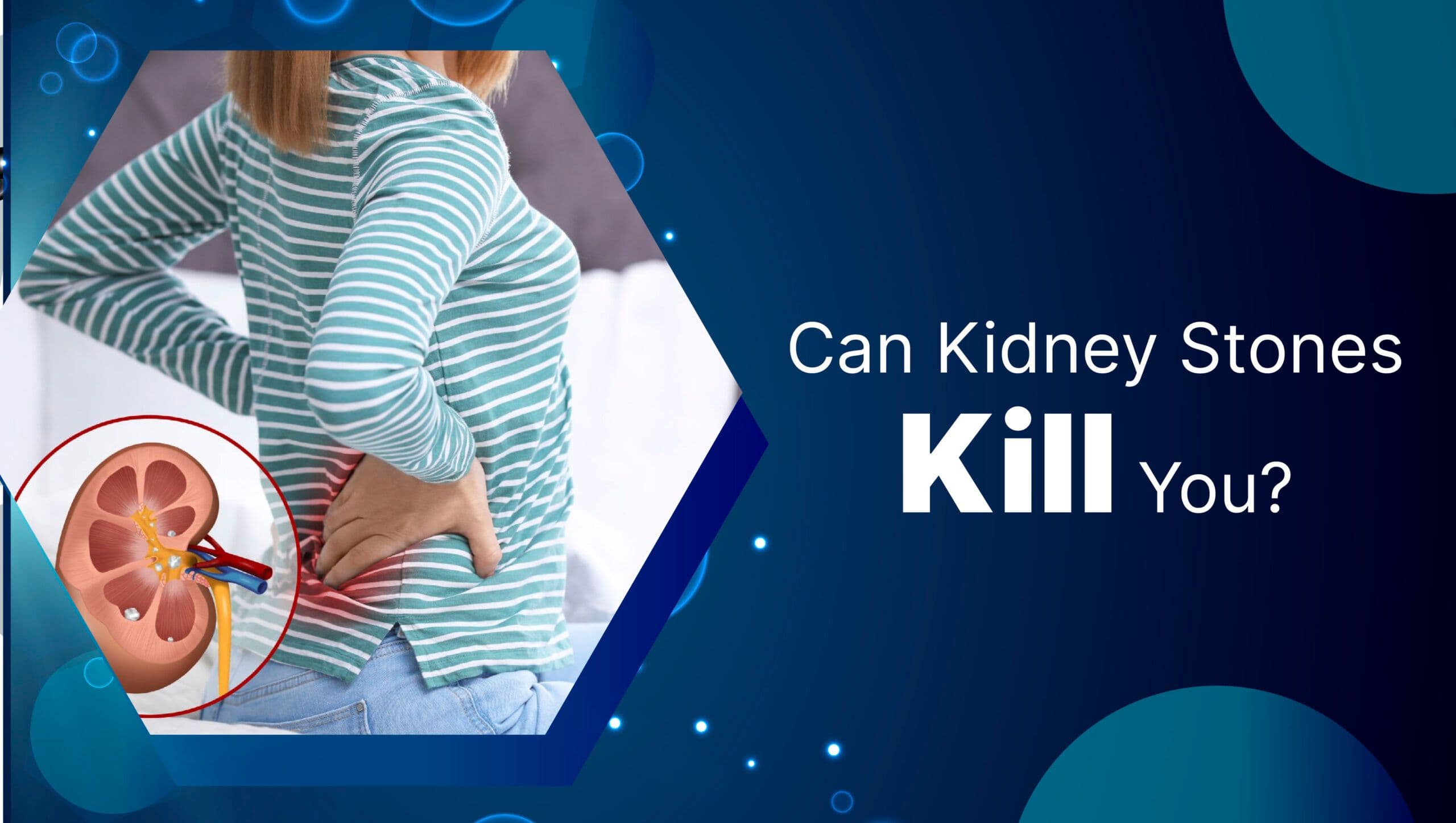 Can Kidney Stones Kill You?
