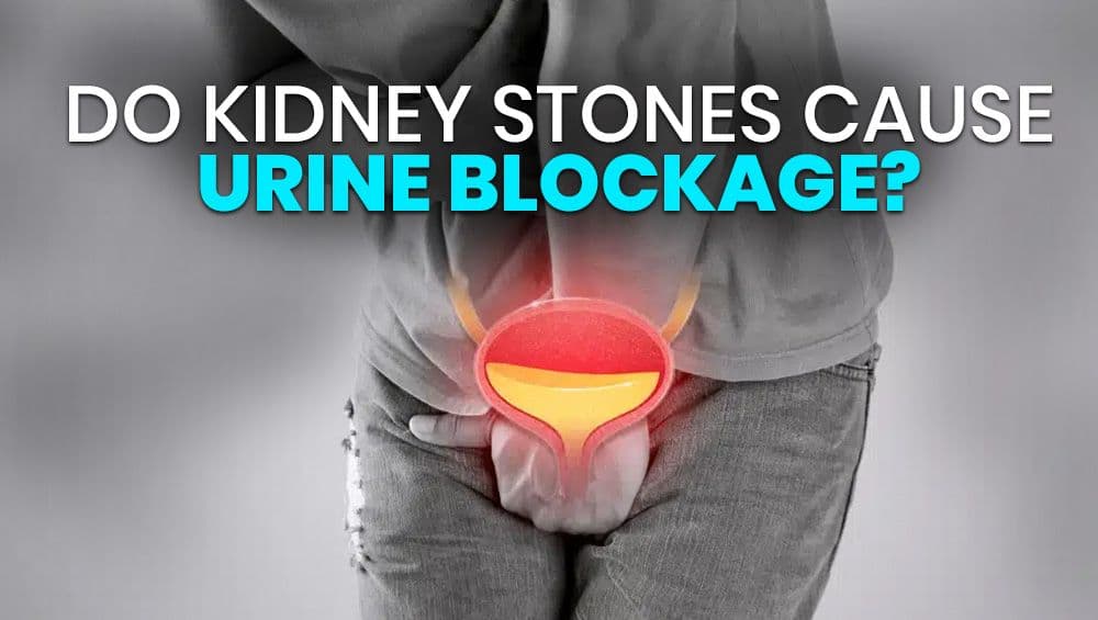 Do Kidney Stones Cause Urine Blockage?