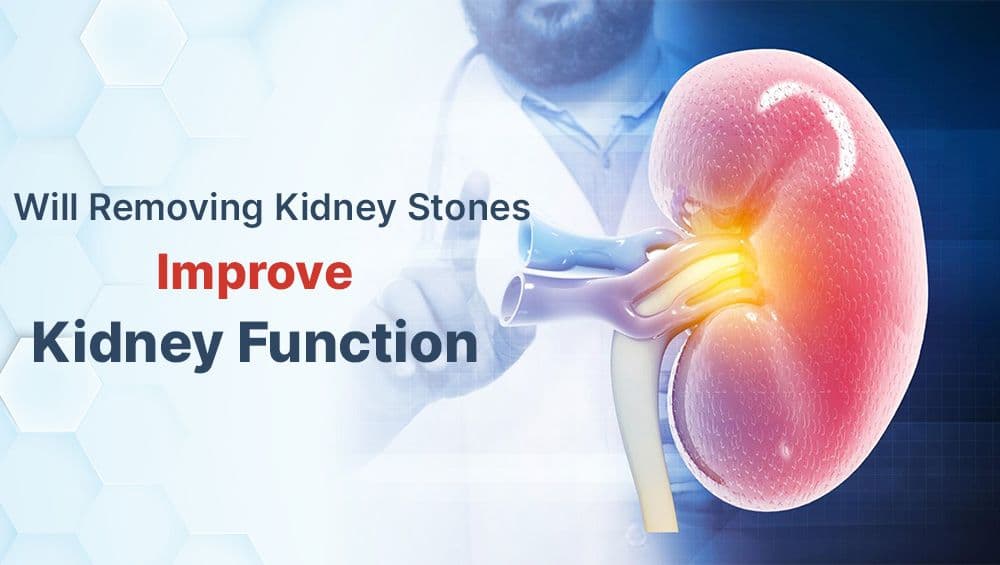Will Removing Kidney Stones Improve Kidney Function?