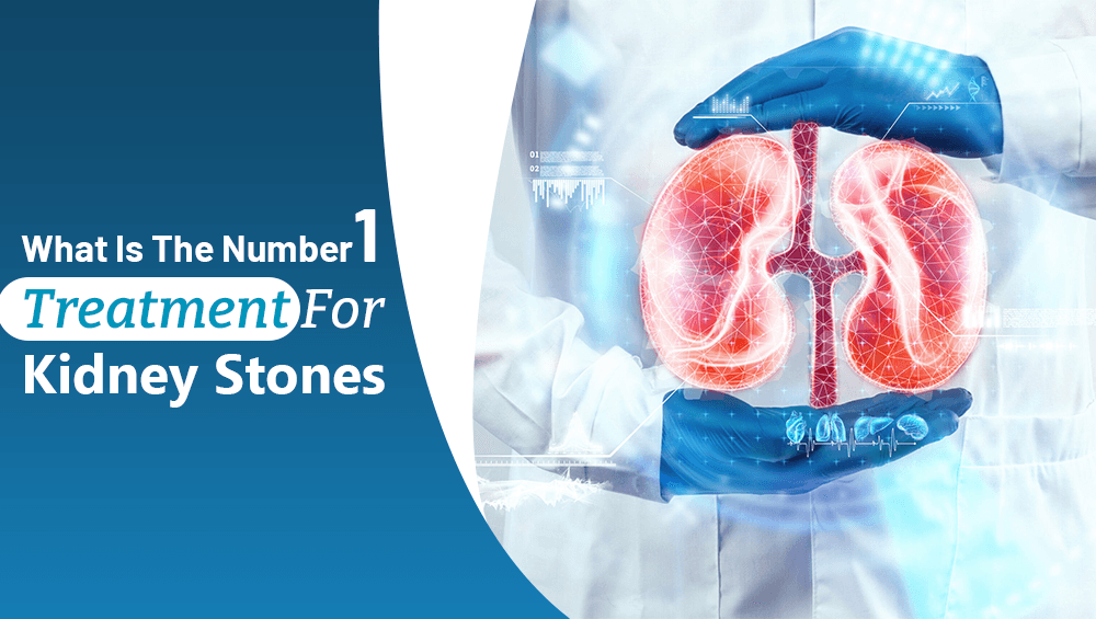 What Is The Number 1 Treatment For Kidney Stones