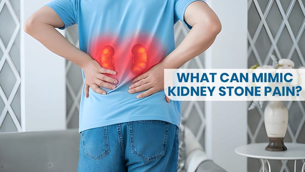 What Can Mimic Kidney Stone Pain?