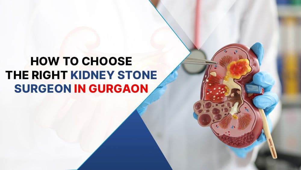 How to Choose the Right Kidney Stone Surgeon in Gurgaon?