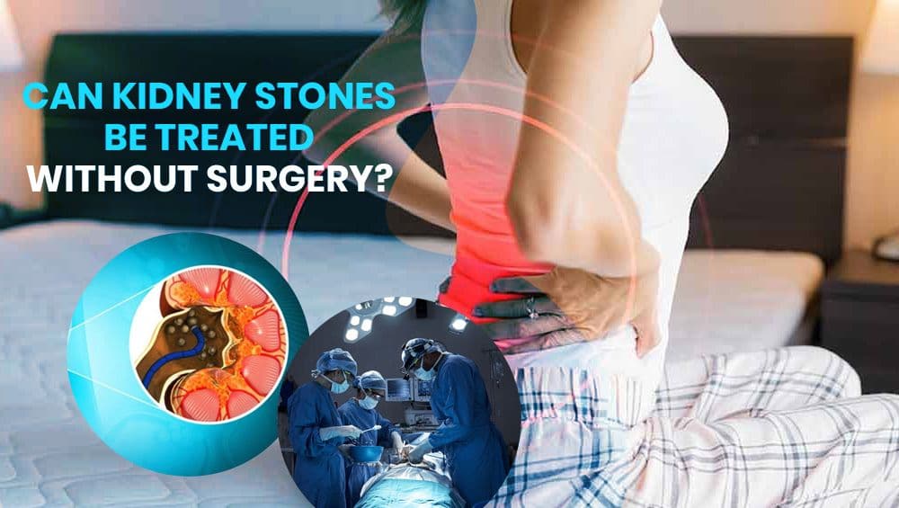 Can kidney stones be treated without surgery?