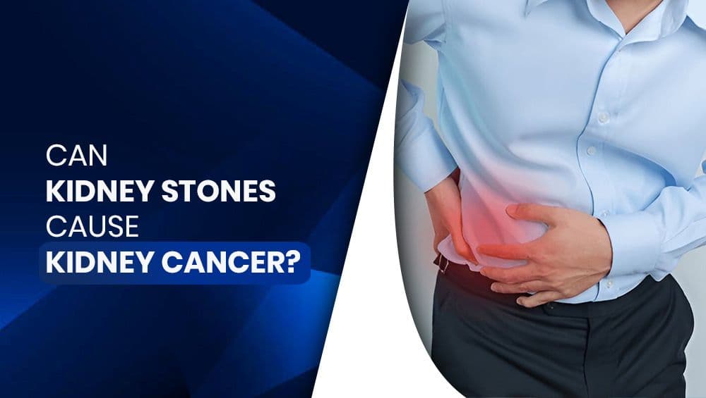 Can Kidney Stones Cause Kidney Cancer?