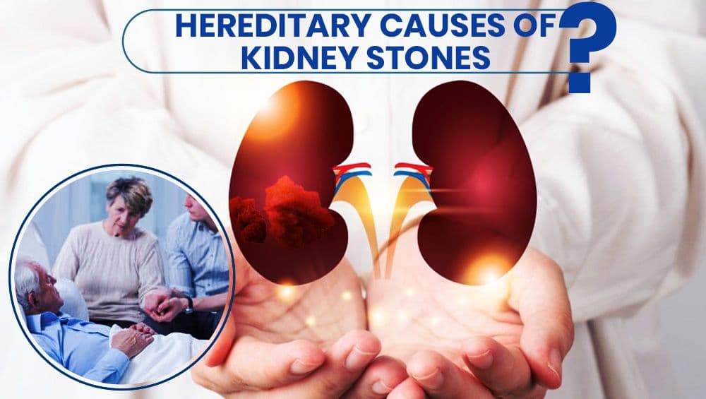 Hereditary causes of kidney stones