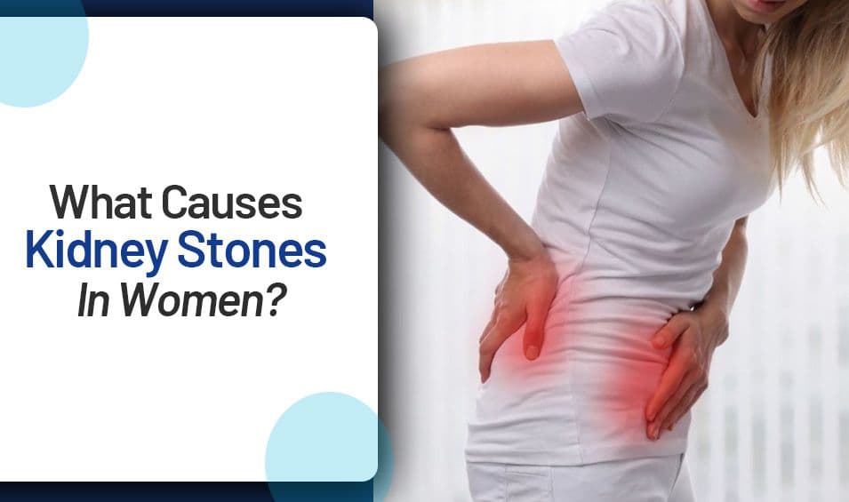 What Causes Kidney Stones in Women?