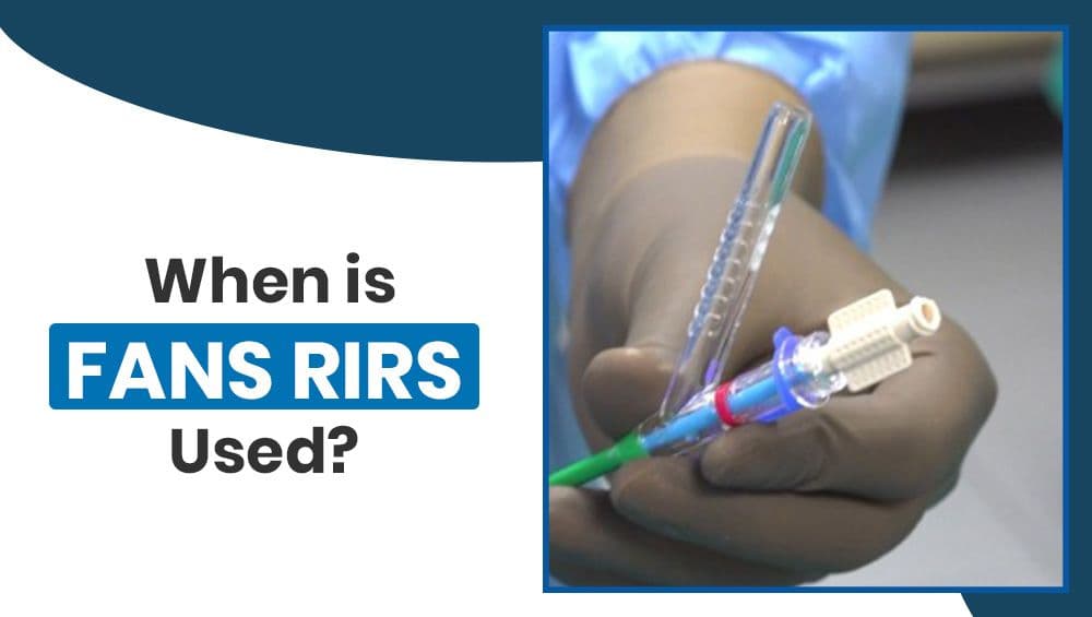 When is FANS RIRS Used?