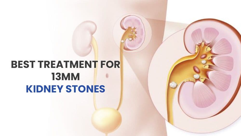 Best Treatment For 13mm Kidney Stones