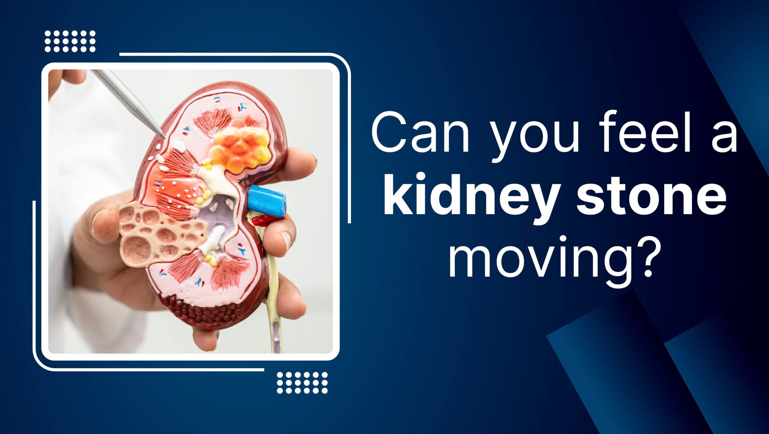 Can you feel a kidney stone moving?