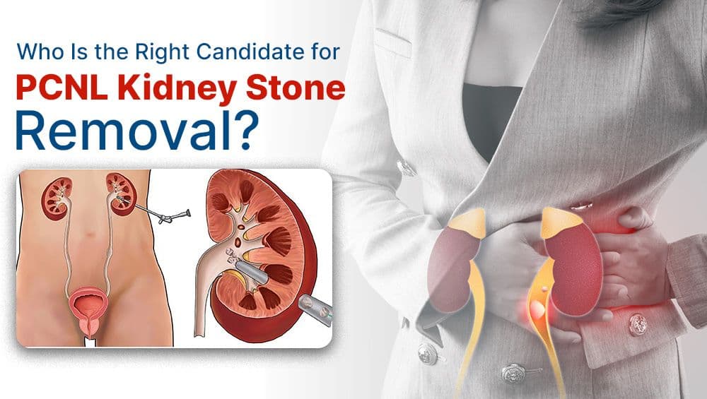 Who Is the Right Candidate for PCNL Kidney Stone Removal?