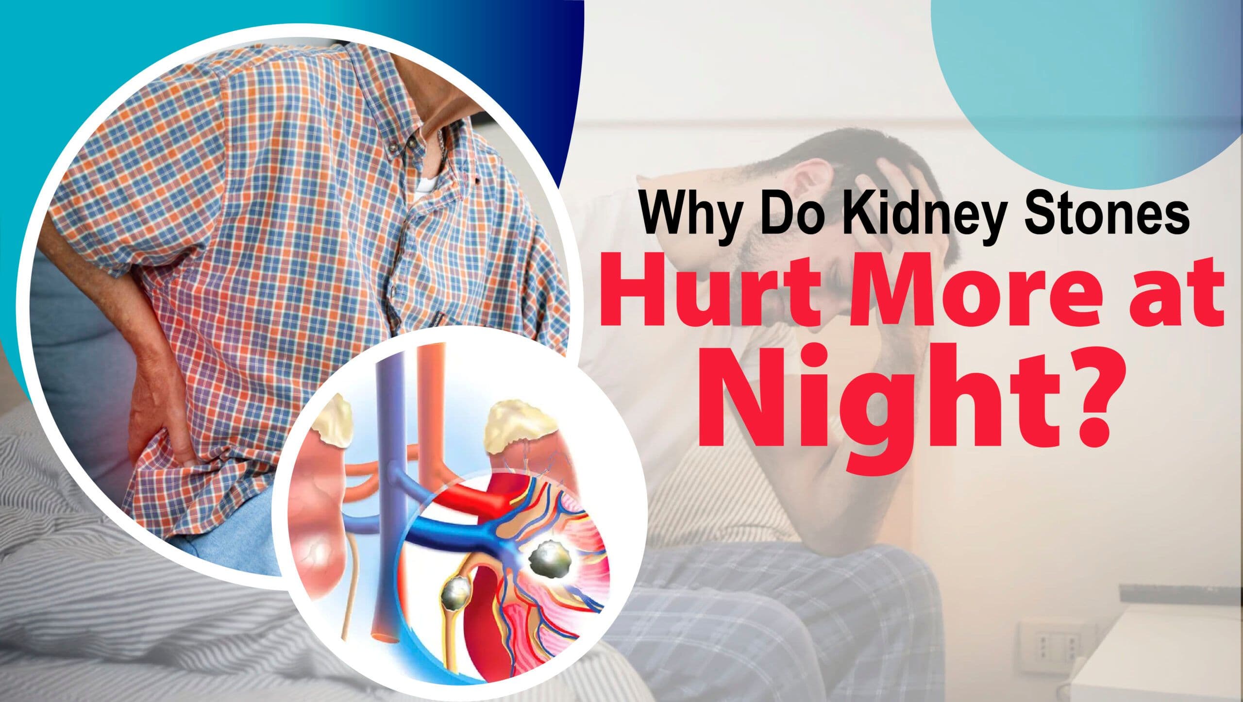 Why Do Kidney Stones Hurt More at Night?