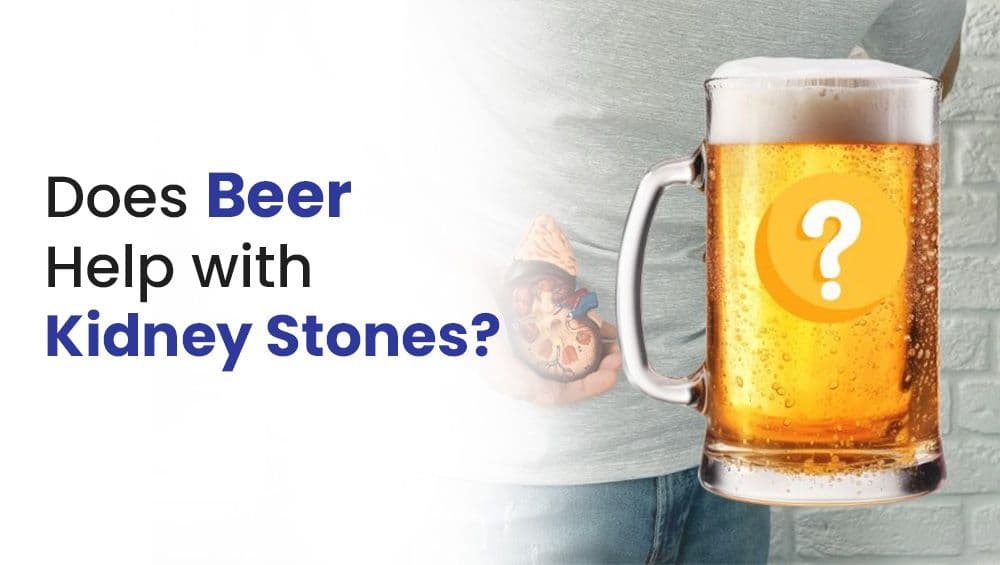 Does Beer Help with Kidney Stones?