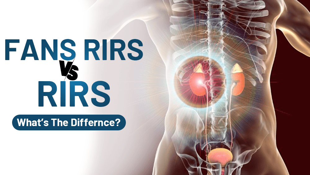 FANS RIRS vs RIRS: What’s The Differnce?