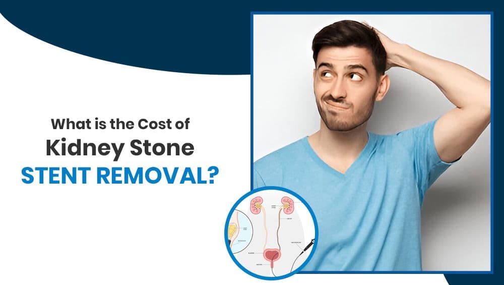 What Is the Cost of Kidney Stone Stent Removal?