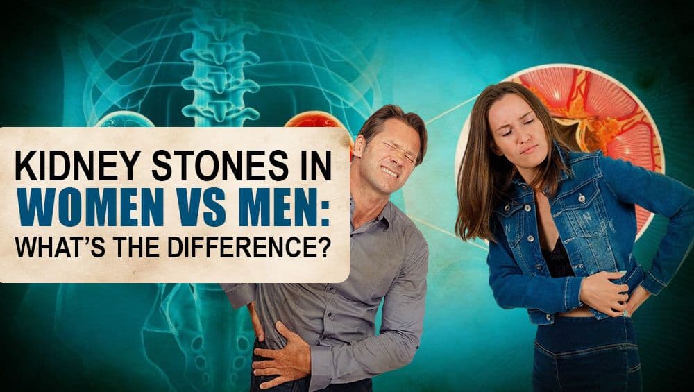 Kidney Stones in Women vs. Men: What’s the Difference?