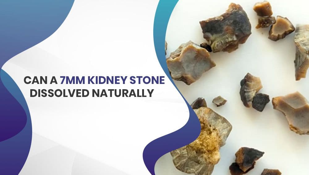Can a 7mm kidney stone dissolve Naturally?