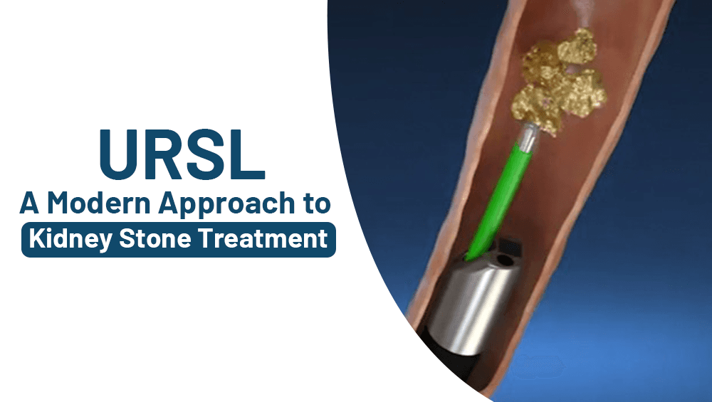 URSL: A Modern Approach to Kidney Stone Treatment
