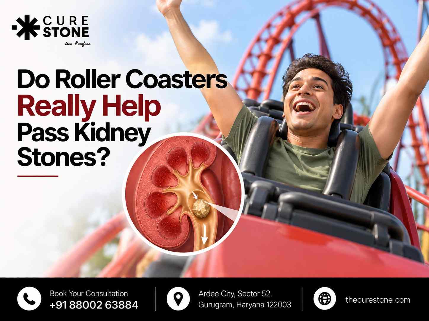 Do Roller Coasters Really Help Pass Kidney Stones?