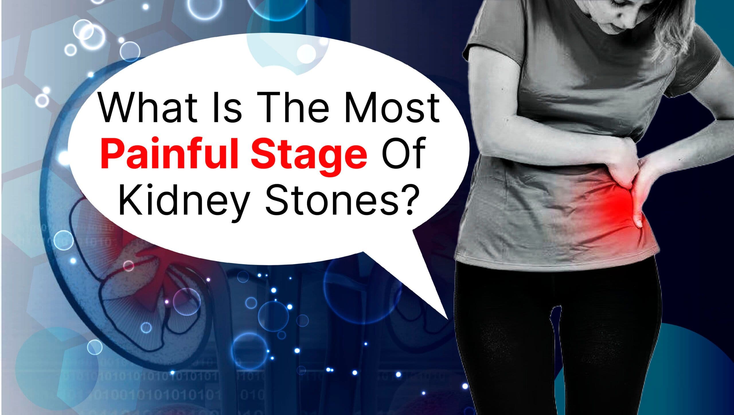 What Is The Most Painful Stage Of Kidney Stones?