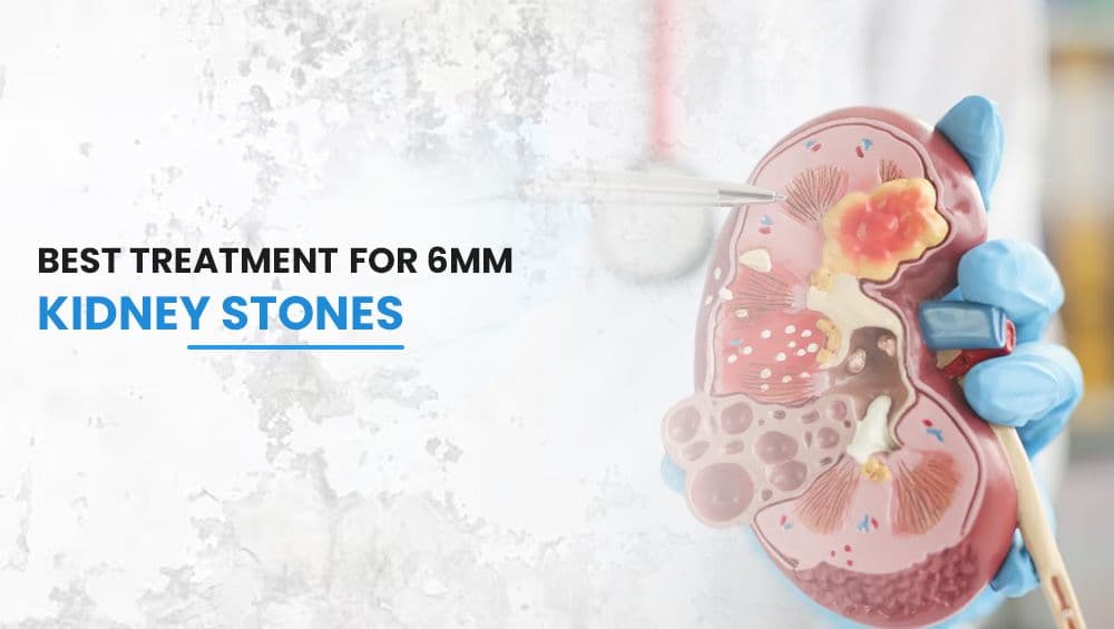 Best Treatment For 6mm Kidney Stones