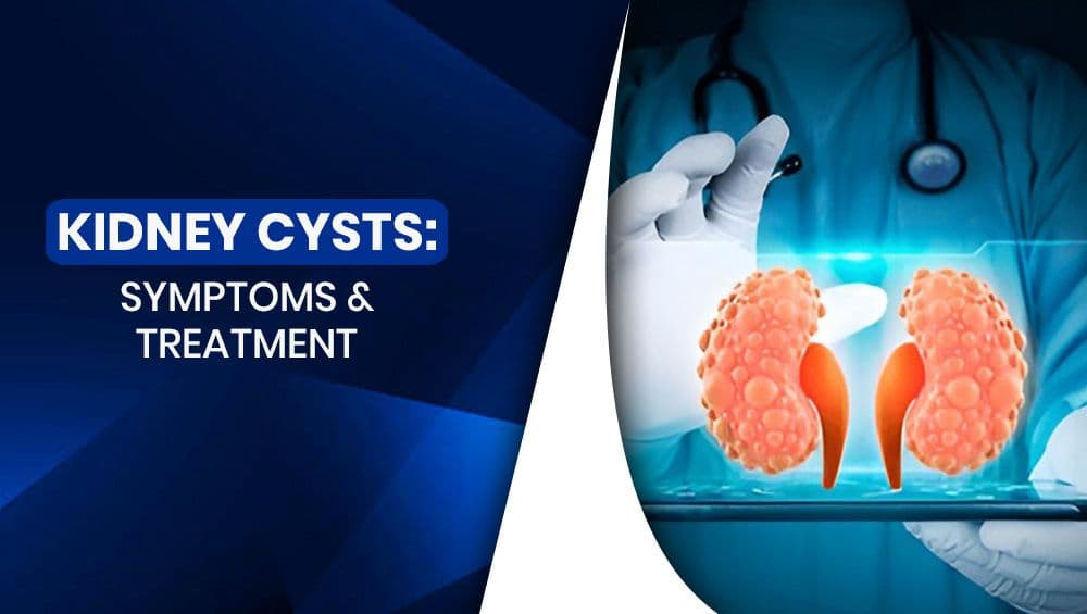 Kidney Cysts: Symptoms & Treatment