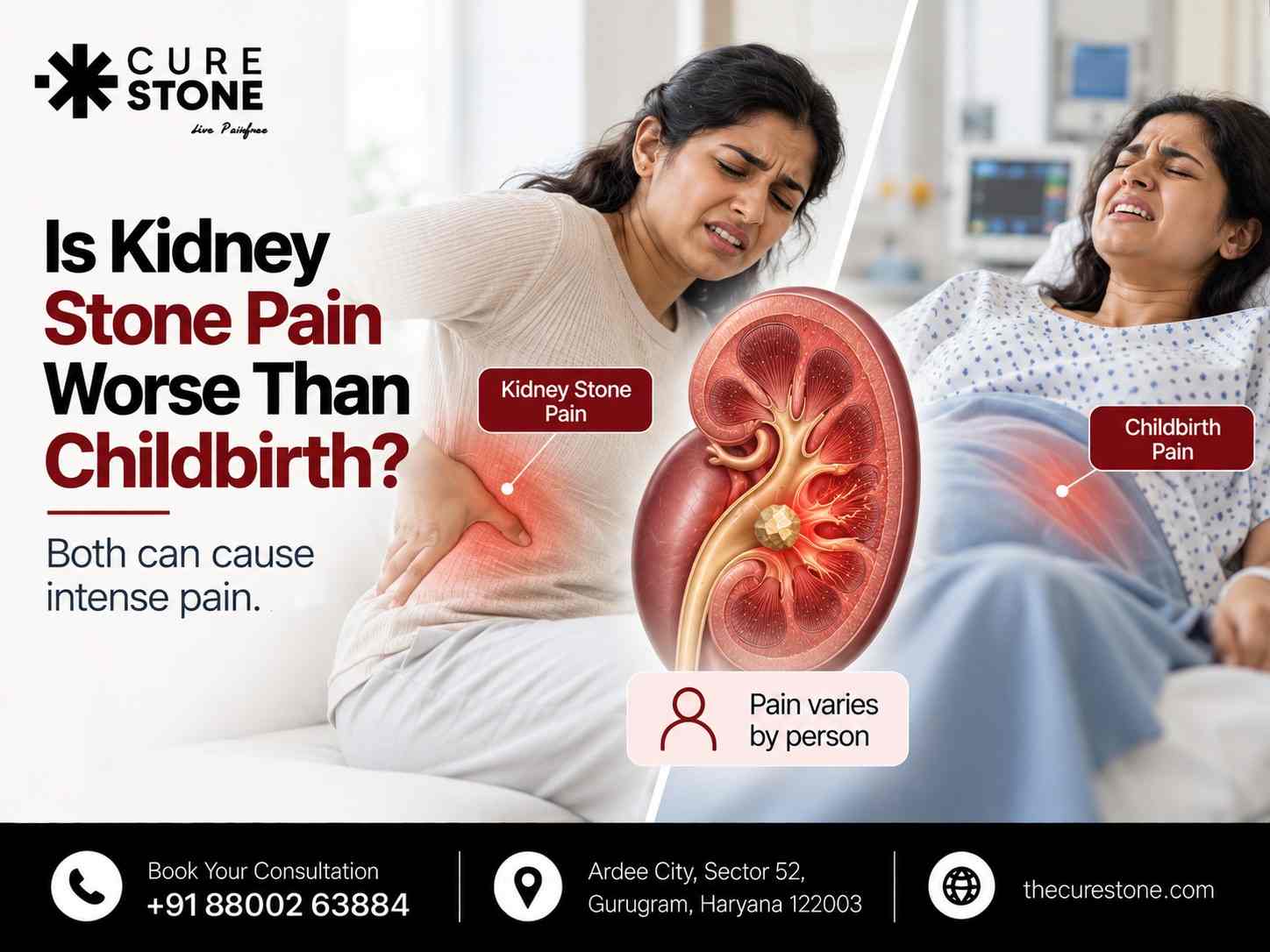 Is Kidney Stone Pain Worse Than Childbirth?