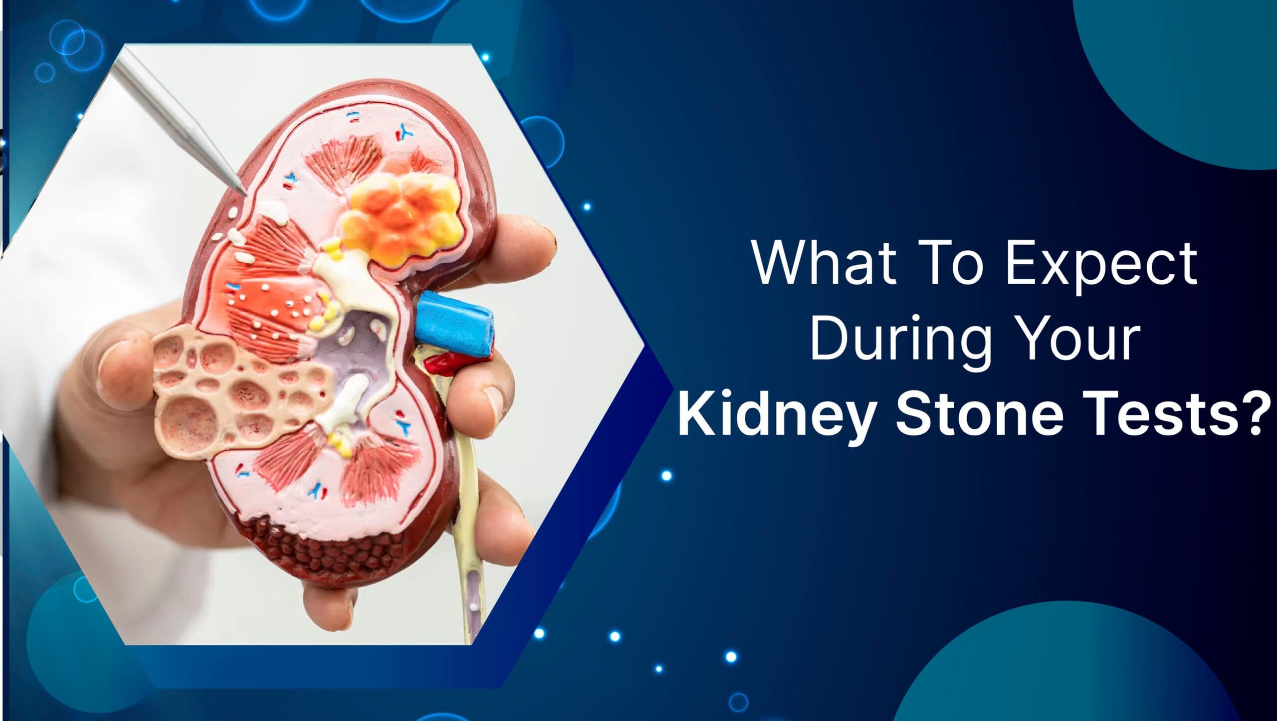 What To Expect During Your Kidney Stone Tests?