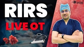 How RIRS Laser Surgery Works — Complete Guide
